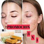 PROMOCION 3X1 JABON DE CURCUMA