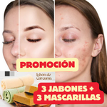 KIT ANTI - ACNÉ JABON DE CURCUMA + MASCARILLA GRATIS